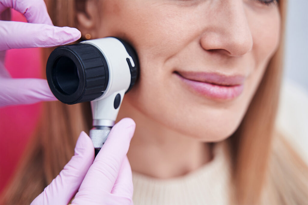 smiling lady getting skin check